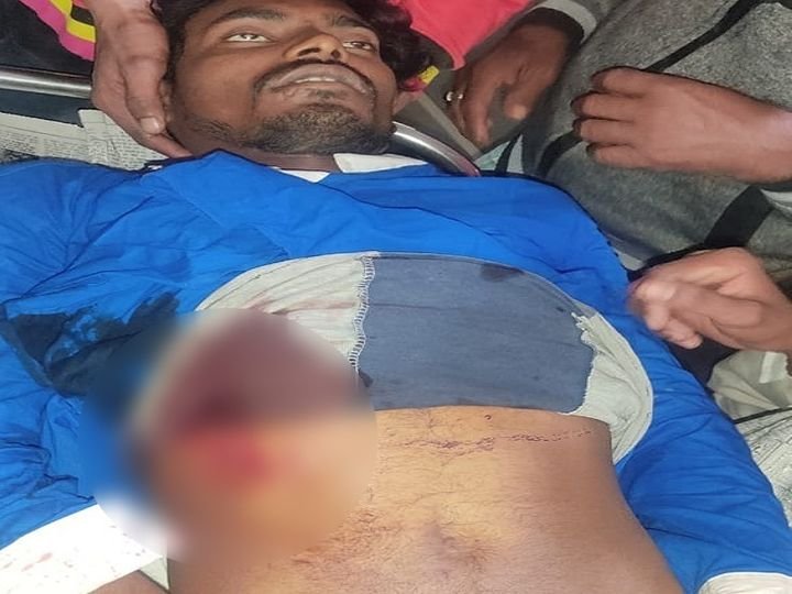 This young man had to get into a quarrel with friends who were having a liquor party