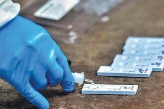 All investigation rates of Corona were reduced…. RTPCR will be Rs 550