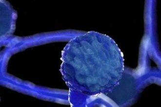 ब्लैक फंगस को लेकर सरकार की एडवायजरी