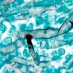 अब ये कैसी मुसीबत, कभी नहीं हुआ कोरोना, फिर भी ब्लैक फंगस की चपेट में आ गए 32 लोग