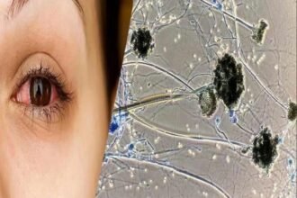 कोरोना ही नहीं ब्लैक फंगस ने भी बढ़ाई सरकार की चिंता, 421 मामले आए सामने