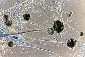 ब्लैक फंगस के संक्रमण से निपटने छत्तीसगढ़ ने कसी कमर…. सीएम बघेल ने छत्तीसगढ़ के सभी जिलों उपचार के लिए सभी जरूरी दवाओं की उपलब्धता सुनिश्चित करने के दिये निर्देश