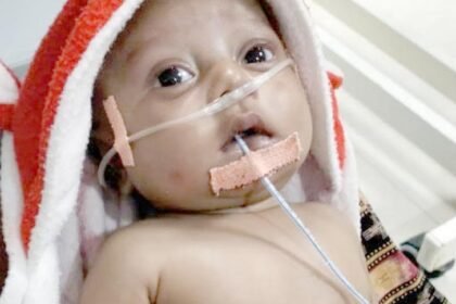 दिल की गंभीर बीमारी से पीडि़त 4 माह के सिद्धार्थ का इलाज कराएगी छत्तीसगढ़ सरकार