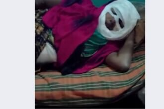 उधारी का पैसा मांगने पर गुंडे ने ठेला चलाने वाली महिला पर फेका खौलता हुआ तेल, गंभीर रूप से झुलसी महिला इलाज को मोहताज