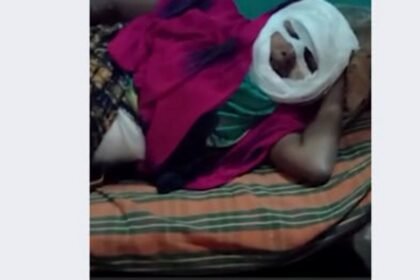 उधारी का पैसा मांगने पर गुंडे ने ठेला चलाने वाली महिला पर फेका खौलता हुआ तेल, गंभीर रूप से झुलसी महिला इलाज को मोहताज