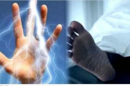 दर्दनाक: शिकार के लिए लगाए करंट की चपेट में आकर पति-पत्नी बुरी तरह झुलसे, महिला का हो गया गर्भपात, काटना पड़ा पैर