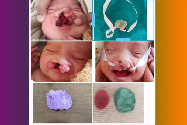 जिला अस्पताल एक और उपलब्धि: फीड नहीं कर पा रहा था 3 दिन का बेबी, चिकित्सकों ने फीडिंग प्लेस बनाकर दी राहत