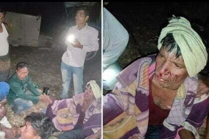 जंगली जावनर शिकार करने को बिछाया था करंट, खेत से आ रहा ग्रामीण आया चपेट में, हालात गंभीर