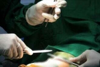 लापरवाही: फ्रैक्चर था कूल्हे की हड्डी में और डॉक्टरों ने कर दिया दिल का आपरेशन, मरीज की मौत