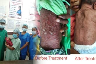 स्वास्थ्य सुविधाओं की बदलती तस्वीर, स्पेशल न्यू बोर्न केयर यूनिट नवजात शिशुओं के लिए बनी संजीवनी