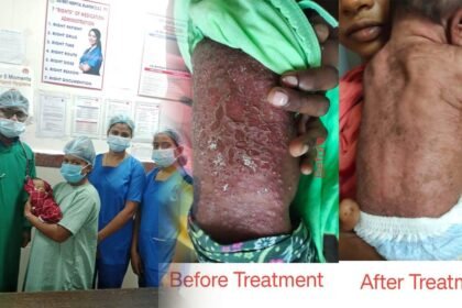 स्वास्थ्य सुविधाओं की बदलती तस्वीर, स्पेशल न्यू बोर्न केयर यूनिट नवजात शिशुओं के लिए बनी संजीवनी