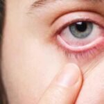 प्रदेश में तेजी से फैल रहा आंखों का संक्रमण, रोज मिल रहे 40-50 मरीज, सबसे ज्यादा बच्चे आ रहे चपेट में