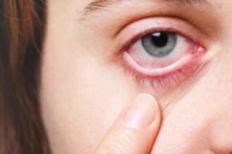 प्रदेश में तेजी से फैल रहा आंखों का संक्रमण, रोज मिल रहे 40-50 मरीज, सबसे ज्यादा बच्चे आ रहे चपेट में