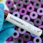 छत्तीसगढ़ में कोरोना के 24 नए मरीज, राजधानी में सबसे ज्यादा संक्रमित, कुल 131 एक्टिव केस