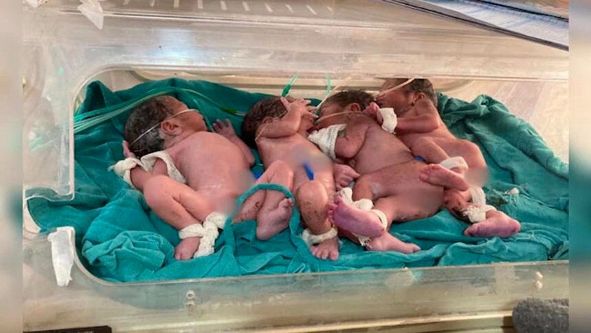 महिला ने दिया एक साथ चार बच्चों को जन्म, दो लड़के, दो लड़कियां….सभी स्वस्थ