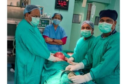 जिला चिकित्सालय दुर्ग में फाईब्राइड पीडि़त मरीज का सफल ऑपरेशन, 3 किलो का निकाला गया गोला