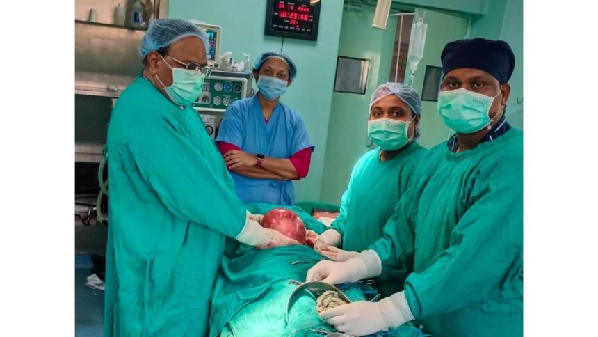 जिला चिकित्सालय दुर्ग में फाईब्राइड पीडि़त मरीज का सफल ऑपरेशन, 3 किलो का निकाला गया गोला