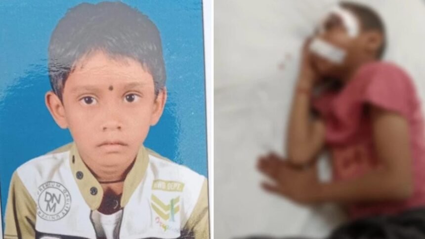 6 साल के बच्चे के साथ ऐसी हैवानियत कि काँप जाएगी रूह, बेरहमी से पिटाई के बाद आंखों में डाला गोंद