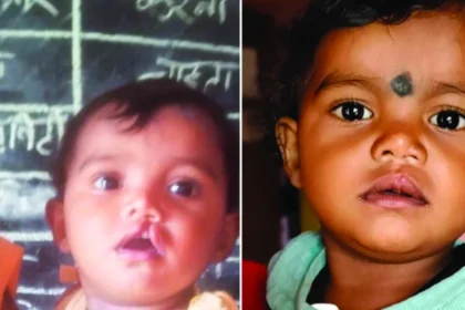 शासन की योजना से दूर हुई बेटी के भविष्य की चिंता, चिरायु दल ने लौटाई मासूम रंजना की मुस्कान