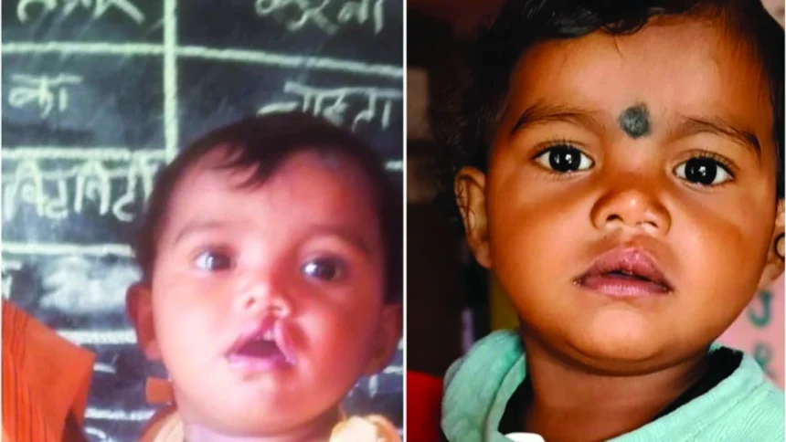 शासन की योजना से दूर हुई बेटी के भविष्य की चिंता, चिरायु दल ने लौटाई मासूम रंजना की मुस्कान